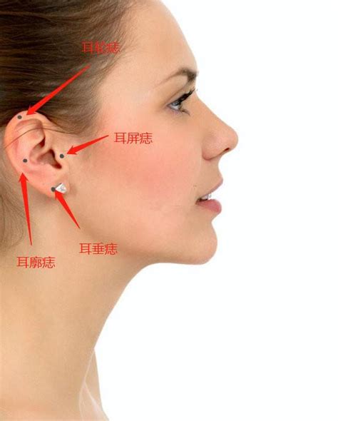 面相耳朵有痣位置